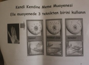 Kanserin kadını erkeği ayıbı bulaşısı yok!