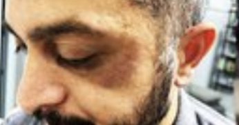 Darıca’da polis şiddeti iddiaları doğru mu?