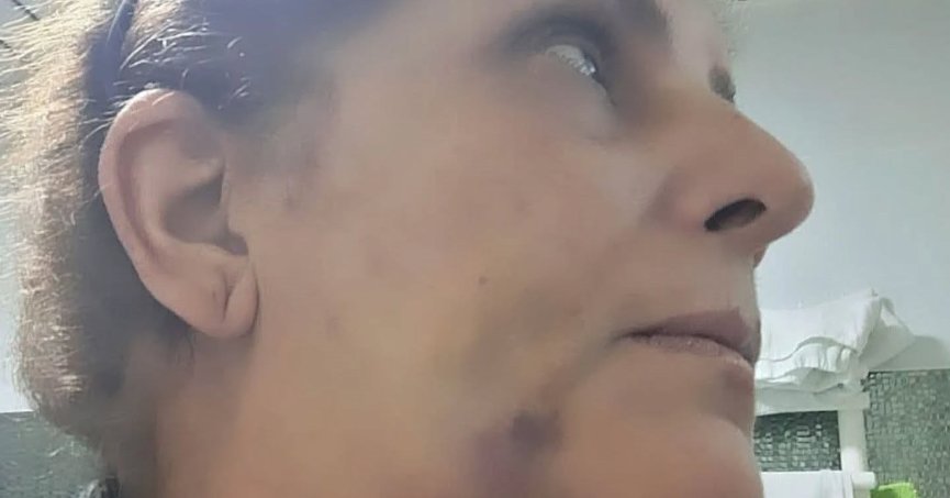 Aynı diş kliniğinden çok kişi davacıymış